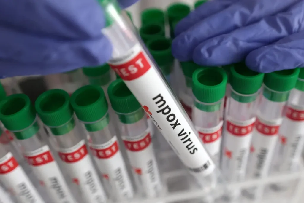 Test tubes labeled for mpox virus testing, held by gloved hands in a laboratory setting.